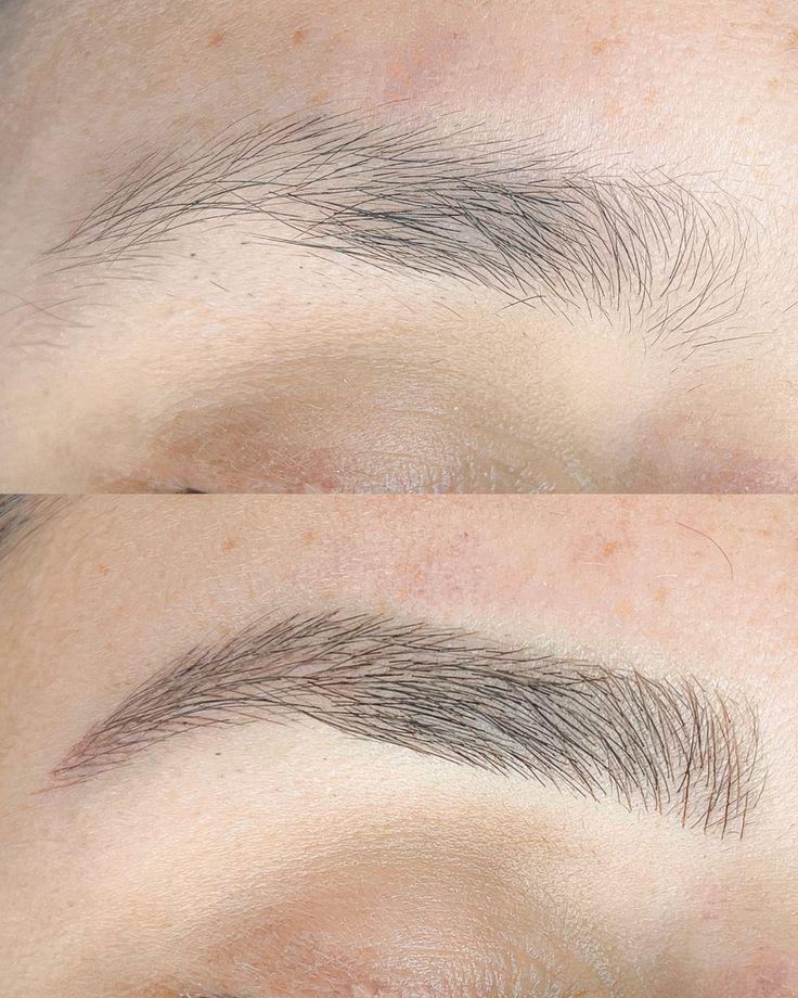 Nanopigmentação exemplo 3