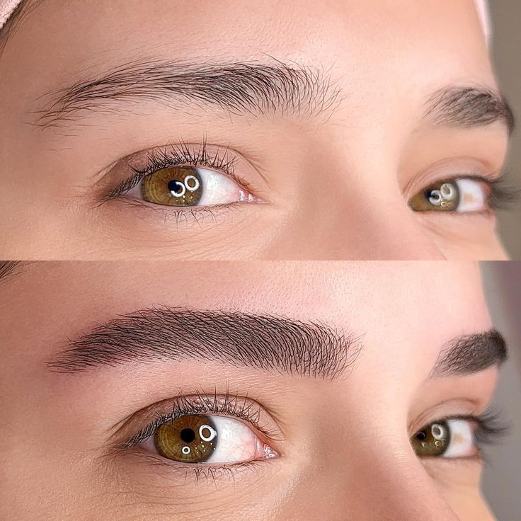 Nanopigmentação exemplo 4