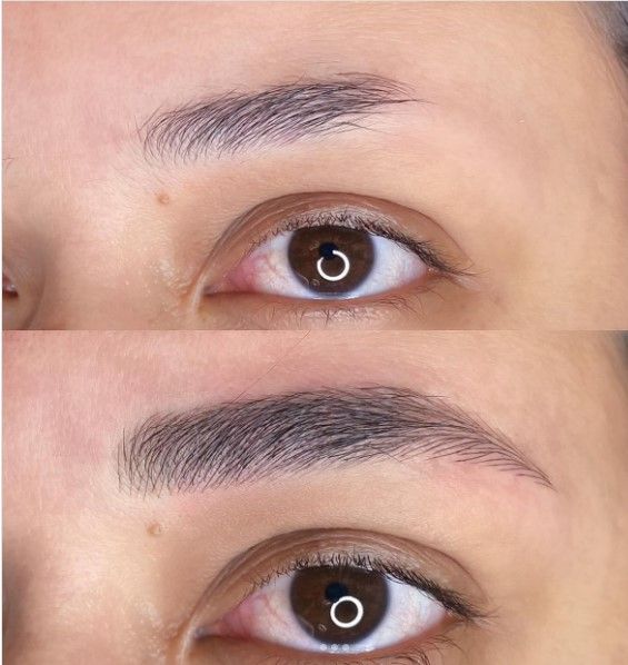 Nanopigmentação exemplo 6